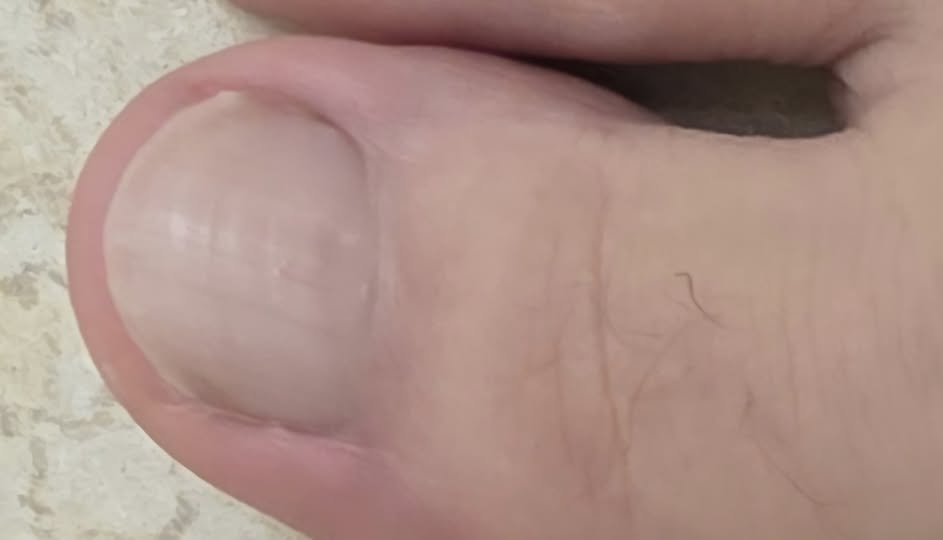 My first pedicure at age 65!